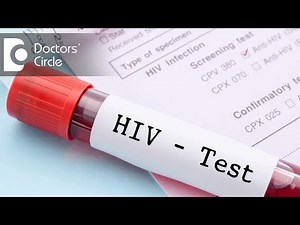 Is HIV -ve status confirmed after non reactive values on 63,86 & 126 days? - Dr. Ramakrishna Prasad