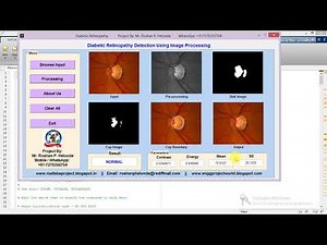 Diabetic Retinopathy Detection Using Image Processing Full Matlab Project Code