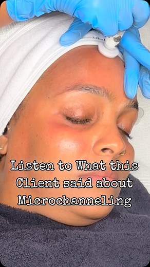 You heard it here first! Clients are raving about their results with Procell Therapies Microchanneling—brighter skin, smoother texture, fewer fine lines, and a radiant glow with minimal downtime! It’s the glow-up that keeps getting better with every session. #procelltherapies #microchanneling #therebeaute Bookmark for later | Kisha Hamilton