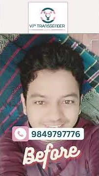 Successful Transformation at Vj’s Transgender Clinic | Successful Male-to-female Surgery