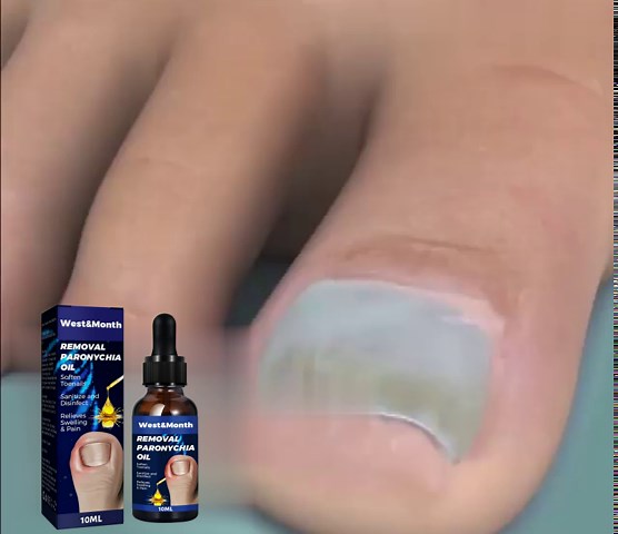 3PCS German Toenail Care Paronychia Oil, Paronychia Treatment, Anti Paronychia Relief Oil for Repair and Improve Toenail Health