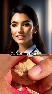 Viral White teeth hack😮🚀 - - - - - - - - - - - - Disclaimer ⚠️: दी गई जानकारी केवल सामान्य जागरूकता के उद्देश्य से है और इसे पेशेवर चिकित्सा सलाह की विकल्प नहीं माना जाना चाहिए। व्यक्तिगत स्वास्थ्य सुझाव के लिए कृपया किसी योग्य चिकित्सक से परामर्श करें #trending #trendingnow #viralreels #viralbeautytips #teeth #whiteteeth #yellow #yellowteeth #beauty #beautyhacks #trendingaudio #viral #viraloninsta | Dailyhelthedge Dailyhelthedge