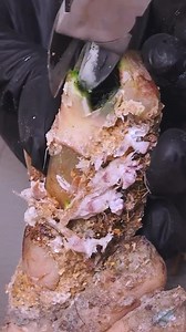 Onychomycosis Nail Repair That Completely Refreshes The Look Part 5 | Osthir Creation