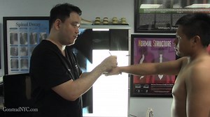 Subscribe to our YouTube Channel to get the latest case studies and like this video! Patient had a Ganglion Cyst for the past 8 months on his right wrist, wrist pain, low back pain, and knee pain that radiates all the way down to the outside of his left foot which is the result of a Common Peroneal Nerve Entrapment due to significant swelling and had pain at the fibular head for the past 4 months. A Structural Test and Gonstead Chiropractic examination was conducted and revealed structural abnor