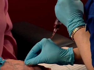 Venipuncture with winged infusion set and syringe