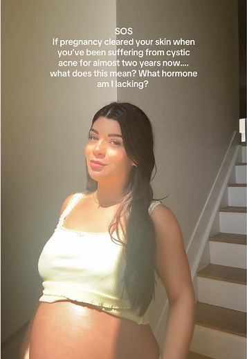 Understanding Pregnancy and Cystic Acne Changes