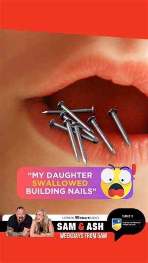 3.6K views · 16 reactions | What did your kid accidently swallow?  | 91.1 Hot FM | Facebook