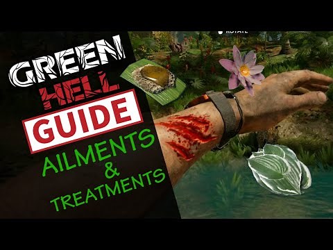 GREEN HELL 2025 / BEGINNERS GUIDE: TREATMENTS, HEALTH & HEALING