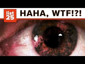 25 Petrifying and Brutal Facts About Lobotomies