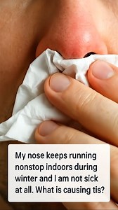 My nose keeps running nonstop indoors during winter and I am not sick at all. What is causing this? | Useful Tips