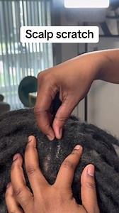 Scalp scratch for dandruff relief: scalp scratch tips
