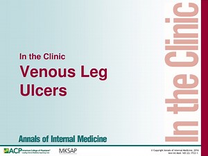 Venous Leg Ulcers - SlideServe