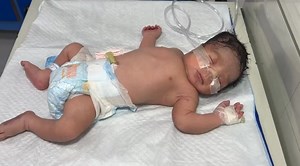 Newborn Baby with Severe Grunting | Critical Breathing Struggle in NICU #baby #newborn #cute #happiness This video shows a newborn baby suffering from severe grunting, a serious sign of breathing difficulty and respiratory distress. Grunting in newborns often indicates that the baby is struggling to keep the lungs open and needs urgent medical attention. In this real NICU journey, doctors and nurses carefully monitor the baby, provide oxygen support, and start timely treatment to stabilize the c