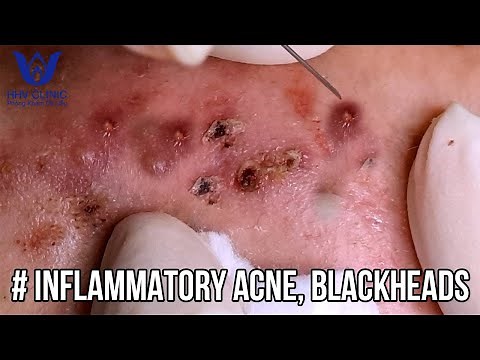 Relax every day with | HHV CLINIC | Hiền Vân Spa #09