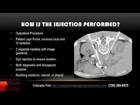 Celiac Plexus Block at a Denver Pain Management Clinic