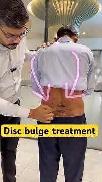 Disc bulge treatment by dr Durgesh | painflame clinic