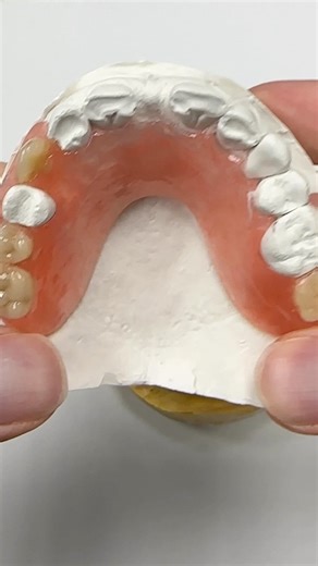 Upper TCS Unbreakable FiberFlex Partial! Case from Dr. Noelle Nubani in Massachusetts. @tcsdentalinc #tcsdentalinc | CEO Luke Kahng