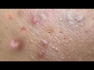 Satisfying Relaxing with Sac Dep Spa Video (#125)