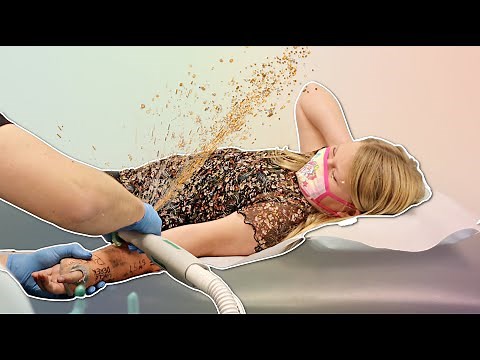 Is Her ARM Still BROKEN?! Cast Removal