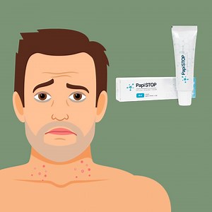 ❗-50%❗A PapiStop krém prémium minőségű alapanyagokból készült, melyek biztonságosan és fájdalommentesen elpusztítják a szemölcsöket ❗-50%❗KORLÁTOZOTT AJÁNLAT 🛒RENDELÉS MOST🛒 https://bit.ly/2LLmoLT ✅A szemölcsök kezelése ✅Állítsa le a papilloma növekedését ✅Nincs mellékhatása ✅Káros vegyi anyagok nélkül ✅Blokkolja a papilloma replikációját és aktivitását 🛒RENDELÉS MOST🛒 https://bit.ly/2LLmoLT ❗-50%❗KORLÁTOZOTT AJÁNLAT | PapiSTOP