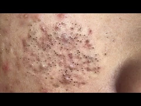 Satisfying and Relaxation with SURI NGUYEN Beauty Spa Video #176