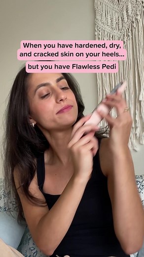 No more hiding those cracked heels! Pedi has your back… or rather, your feet! 🤭👣 #FlawlessBeauty #skincare #selfcare #girlsbelike #Flawless #crackedheels #pedi