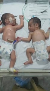 Newborn Baby on Oxygen Support: Causes, Care Tips, and Parent Guidance If your newborn baby is oxygen-dependent, you may have questions about their condition, care, and long-term outlook. Learn about common reasons for oxygen dependency in newborns (such as prematurity, respiratory distress syndrome, or congenital conditions), how to care for your baby at home with oxygen support, and when they might outgrow the need for supplemental oxygen. Get expert advice and reassurance for parents navigati