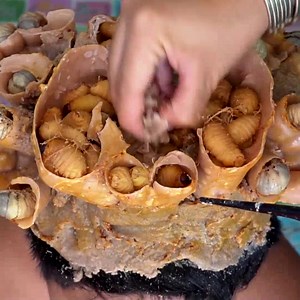 Itchy Dry Scalp Big Dandruff Scratching!! - Scratching Off Scalp Psoriasis #2106 Part 2 | Help remove ticks