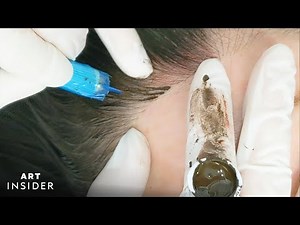 Hairline Microblading Gives The Appearance of Fuller Hair