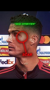 895K views · 10K reactions | Ronaldo's painful memory 凉凉凉 . . . . . . . #cr7 #cristianoronaldo #ronaldo #sadmoment #ronaldosadmoments #ronaldofans #EmotionalMoments #footballsadmoments #footballfans #footballlovers | Sports Tablet | Facebook