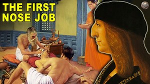 94K views · 1.1K reactions | #Rhinoplasty #MedicalHistory #WeirdHistory | Weird History | Facebook