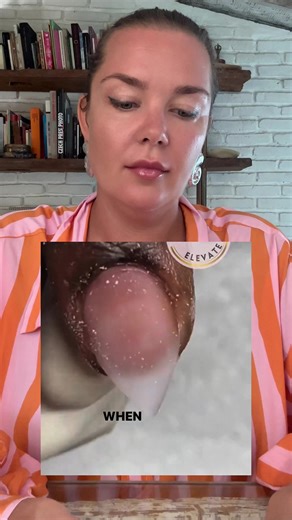 Master Nail Shaping Techniques for Injury-Free Results