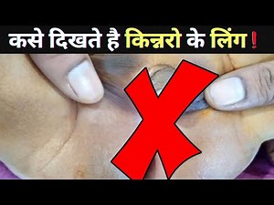 देखिये किंनर के गुप्तंग किस तरह के होते है || facts education video || transgender body parts. hijra