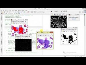 Blood Cancer Detection Using Matlab Project with Source Code Final Year Project | Leukemia Detection
