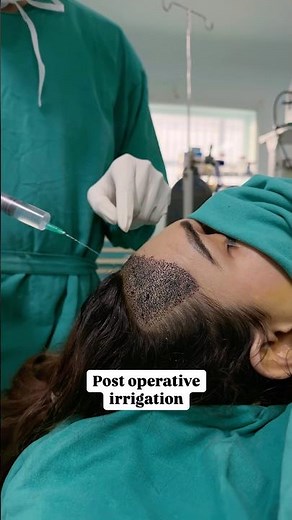 Hairline Correction in MTF Transition | Feminine U-Shaped Hairline Explained by Dr. Kaushik