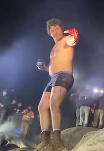 Man Hand Destroyed When Firework Explodes At His Hand