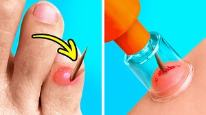 Emergency hacks, first aid tips and gadgets for clumsy people! 🤕 | 5-Minute MAGIC