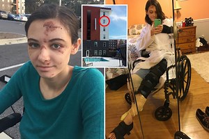 ‘Drunk’ nursing assistant, 22, fell from 4th floor window after mixing prozac and whiskey causing horror injuries