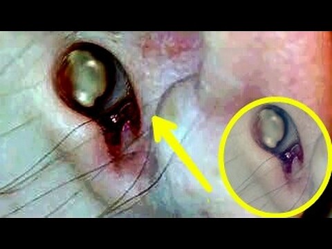 Big Blackhead In Ear | Biggest Blackhead Ever