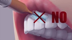 ¿Sabes cómo utilizar un cepillo interproximal? te ayudarán a tener unas encías sanas | GUM