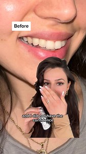 Want sparkling white teeth? Simply pair our Pro Whitening Gel with your toothpaste for a whiter, brighter smile—no strips, no trays, no hassle! | smileactives | Facebook