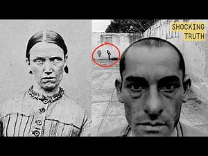 Shocking Old Photos of Mental Asylums That Reveal The Dark Truth!
