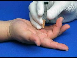 Hand Injection Techniques - Intermetacarpal Injections