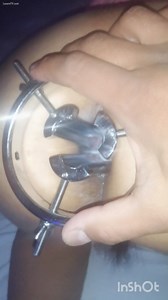 Kinky lady with hairy pussy fisting her ass and inserted a metal brace inside it