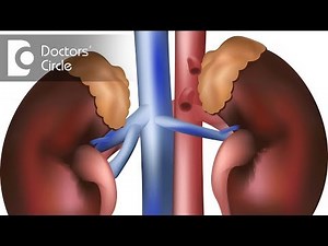 How to recognise signs of adrenal gland benign tumor? - Dr. Anantharaman Ramakrishnan