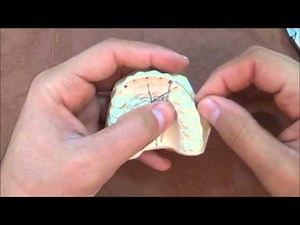 Simple finger spring