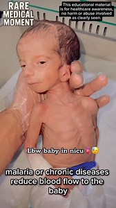 6.7K views · 43 reactions | Low birth weight: causes every mother should know ⚠️ | Mabel Learning Corner For All | Facebook