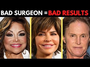 Wanting a Facelift? Watch this before choosing your Surgeon - 3 Important Things To look For!