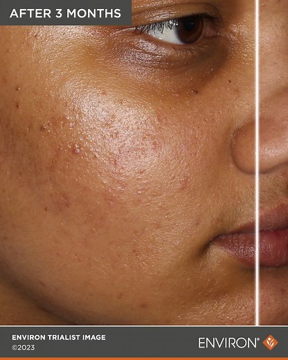 Focus Care Clarity & problemhud | Environ Skin Care