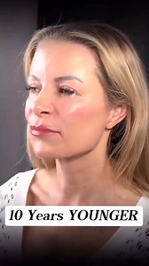 29 reactions | Smaller incision. Bigger impact. The Mini Facelift targets early aging signs with minimal downtime — perfect for modern lifestyles. Trusted technique by Dr. Víctor Verdugo, board-certified facial surgeon in Tijuana.  Subtle. Sophisticated. Surgical. | DR Victor Verdugo | Facebook